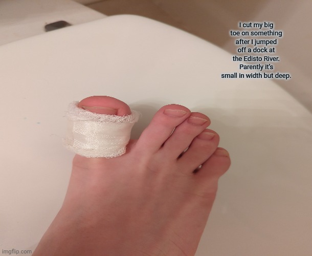 I cut my big toe on something after I jumped off a dock at the Edisto River. Parently it's small in width but deep. | made w/ Imgflip meme maker