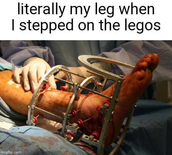 ouch |  literally my leg when I stepped on the legos | image tagged in broken leg,memes,lego,don't try this at home,trust me | made w/ Imgflip meme maker