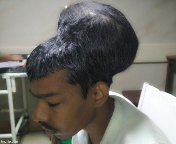 this guy's tumor looks like he's got a second brain | made w/ Imgflip meme maker