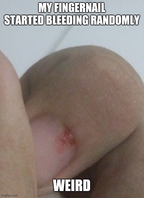 MY FINGERNAIL STARTED BLEEDING RANDOMLY; WEIRD | made w/ Imgflip meme maker