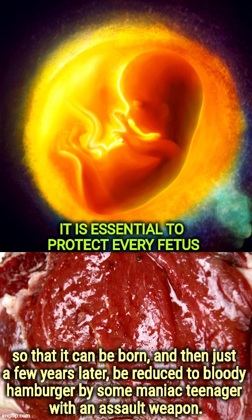 Pro-Life, YEAH! | IT IS ESSENTIAL TO 
PROTECT EVERY FETUS; so that it can be born, and then just 

a few years later, be reduced to bloody 
hamburger by some maniac teenager 
with an assault weapon. | image tagged in pro life,second amendment,assault weapons,fetus | made w/ Imgflip meme maker