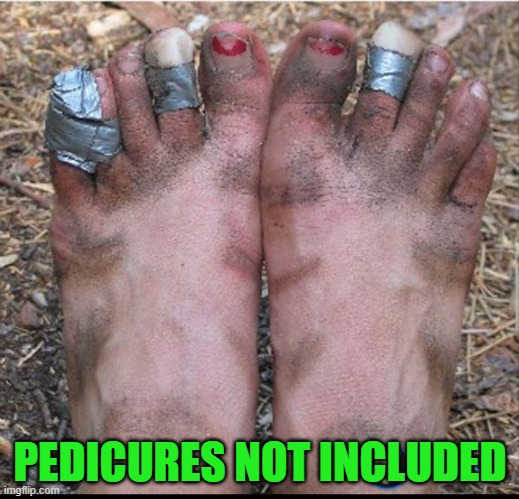 Ugly feet | PEDICURES NOT INCLUDED | image tagged in ugly feet | made w/ Imgflip meme maker