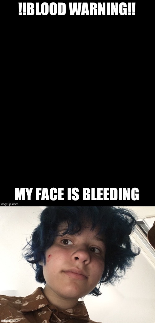 !!BLOOD WARNING!! MY FACE IS BLEEDING | image tagged in double long black template | made w/ Imgflip meme maker