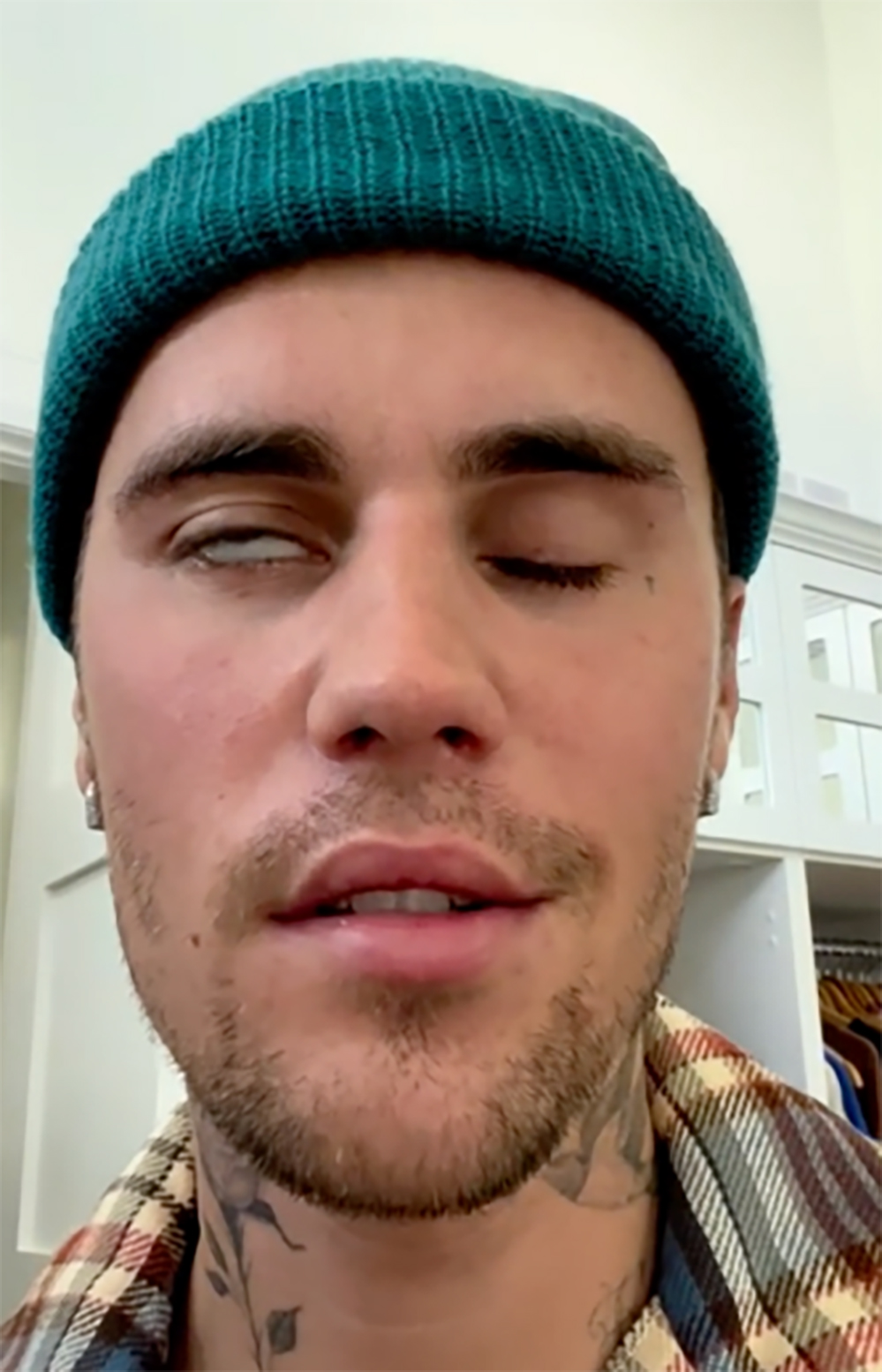 High Quality Justin Bieber Face Paralyzed Blank Meme Template