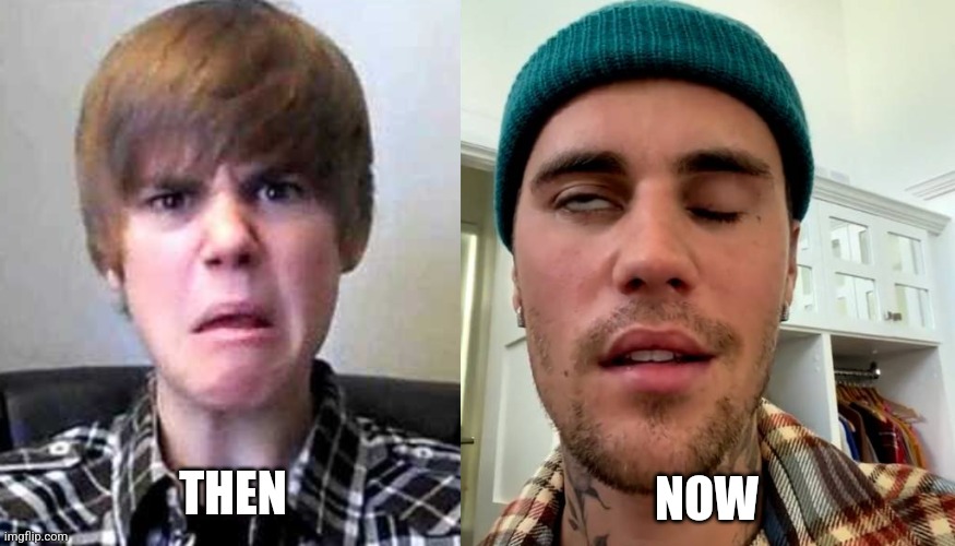He went from "BABY BABY BABY OOOOH" to Face Paralysis | NOW; THEN | image tagged in justin bieber,ramsay hunter syndrome,then and now,wtf | made w/ Imgflip meme maker