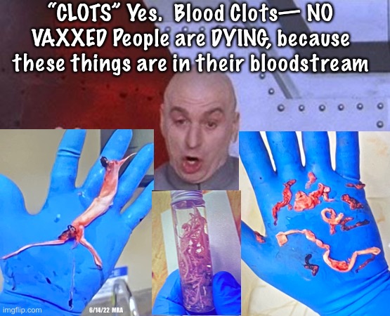 The Clot thickens, the Plot thickens — these CLOTS are getting bigger in the CoVaxxed |  “CLOTS” Yes.  Blood Clots— NO
VAXXED People are DYING, because
these things are in their bloodstream; 6/14/22  MRA | image tagged in memes,dr evil laser,bioweapon keeps evolving,nothing good,its all bad all the time,evil ingredients from evil men | made w/ Imgflip meme maker
