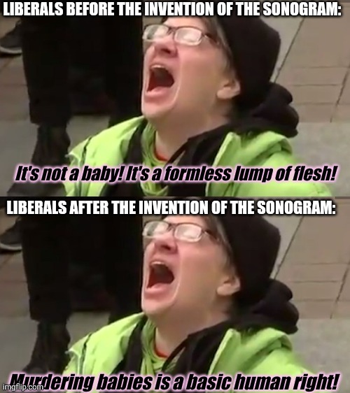 KiLLiNg bAbIeS iS mAh raghT | LIBERALS BEFORE THE INVENTION OF THE SONOGRAM:; It's not a baby! It's a formless lump of flesh! LIBERALS AFTER THE INVENTION OF THE SONOGRAM:; Murdering babies is a basic human right! | image tagged in screaming liberal,liberal logic,if babies didnt wanna be killed,they woulda said something | made w/ Imgflip meme maker