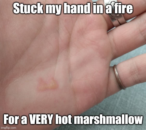 Tis but a mere 1st degree burn | Stuck my hand in a fire; For a VERY hot marshmallow | image tagged in owch,pain,fire | made w/ Imgflip meme maker