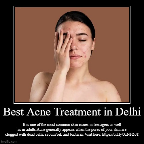 Best Acne Treatment in Delhi | It is one of the most common skin issues in teenagers as well as in adults.Acne generally appears when the po | image tagged in funny,demotivationals | made w/ Imgflip demotivational maker