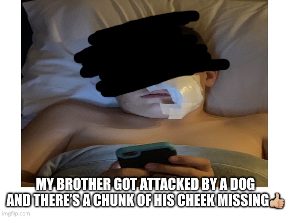 MY BROTHER GOT ATTACKED BY A DOG AND THERE’S A CHUNK OF HIS CHEEK MISSING👍🏼 | image tagged in bad luck,dog,bite | made w/ Imgflip meme maker