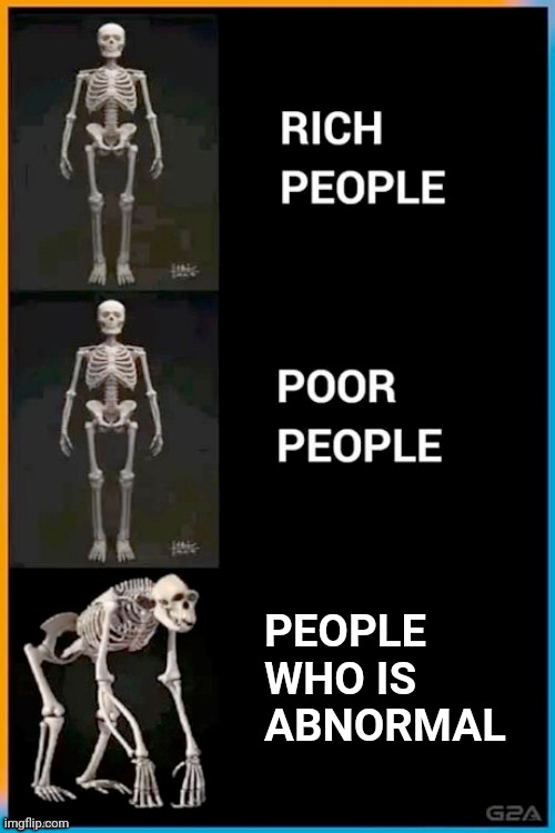 Abnormal human skeleton |  PEOPLE WHO IS ABNORMAL | image tagged in abnormal human skeleton | made w/ Imgflip meme maker