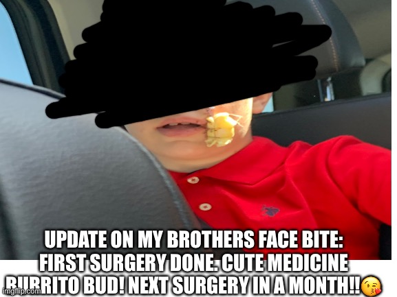 UPDATE ON MY BROTHERS FACE BITE: FIRST SURGERY DONE. CUTE MEDICINE BURRITO BUD! NEXT SURGERY IN A MONTH!!😘 | image tagged in update,bite,bad luck | made w/ Imgflip meme maker