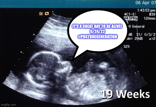 ultrasound | IT'S A GREAT DAY TO BE ALIVE! 
6/24/22
#POSTROEGENERATION | image tagged in ultrasound | made w/ Imgflip meme maker