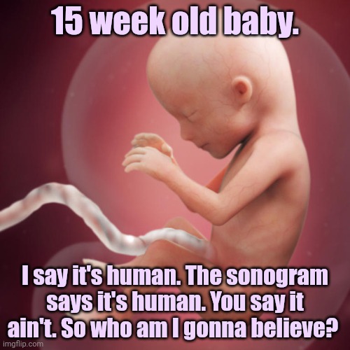 15 week old baby. I say it's human. The sonogram says it's human. You say it ain't. So who am I gonna believe? | made w/ Imgflip meme maker