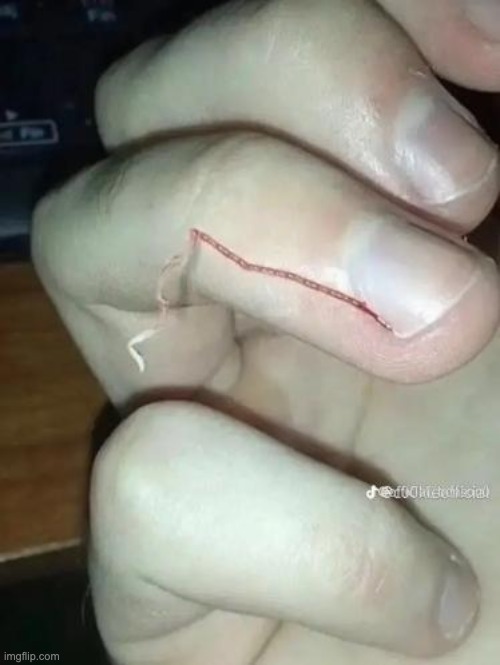 skill issue | made w/ Imgflip meme maker