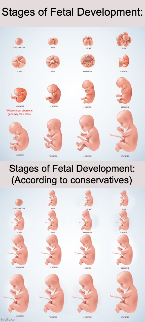 A science lesson for y'all. | Stages of Fetal Development:; *Where most abortions generally take place; Stages of Fetal Development:; (According to conservatives) | image tagged in abortion,pro life,roe v wade,fetus | made w/ Imgflip meme maker