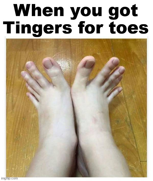 When you got Tingers for toes | image tagged in cursed image | made w/ Imgflip meme maker