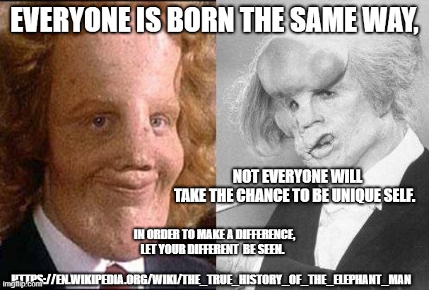 Im Different | EVERYONE IS BORN THE SAME WAY, NOT EVERYONE WILL TAKE THE CHANCE TO BE UNIQUE SELF. IN ORDER TO MAKE A DIFFERENCE,  LET YOUR DIFFERENT  BE SEEN. 
 
HTTPS://EN.WIKIPEDIA.ORG/WIKI/THE_TRUE_HISTORY_OF_THE_ELEPHANT_MAN | image tagged in im different | made w/ Imgflip meme maker