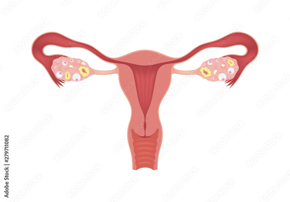 High Quality Uterus Blank Meme Template
