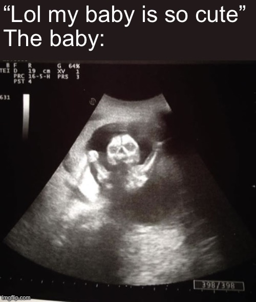 ultrasound | “Lol my baby is so cute”
The baby: | image tagged in ultrasound | made w/ Imgflip meme maker