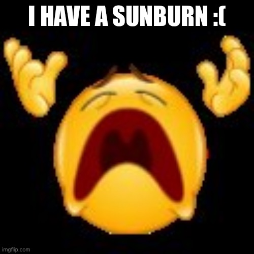 Crying Emoji | I HAVE A SUNBURN :( | image tagged in crying emoji | made w/ Imgflip meme maker