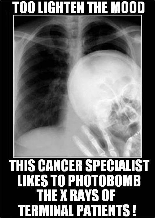 One Mean Doctor ! | TOO LIGHTEN THE MOOD; THIS CANCER SPECIALIST LIKES TO PHOTOBOMB; THE X RAYS OF  TERMINAL PATIENTS ! | image tagged in terminal,cancer,x rays,photobomb,dark humour | made w/ Imgflip meme maker