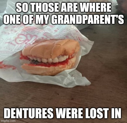 Dentures | SO THOSE ARE WHERE ONE OF MY GRANDPARENT'S; DENTURES WERE LOST IN | image tagged in comment section,comments,comment,dentures,memes,denture | made w/ Imgflip meme maker