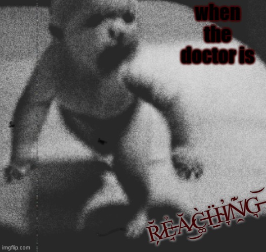 Terror infant | when the doctor is; R̷̗̆Ẻ̵̘Ă̷͜C̶͚̀Ḧ̴̠I̸̞̓N̸̯͊G̶͉͝ | image tagged in terror infant,surreal,horror | made w/ Imgflip meme maker