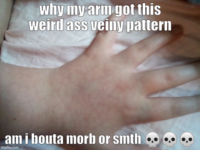 why my arm got this weird ass veiny pattern; am i bouta morb or smth 💀💀💀 | made w/ Imgflip meme maker