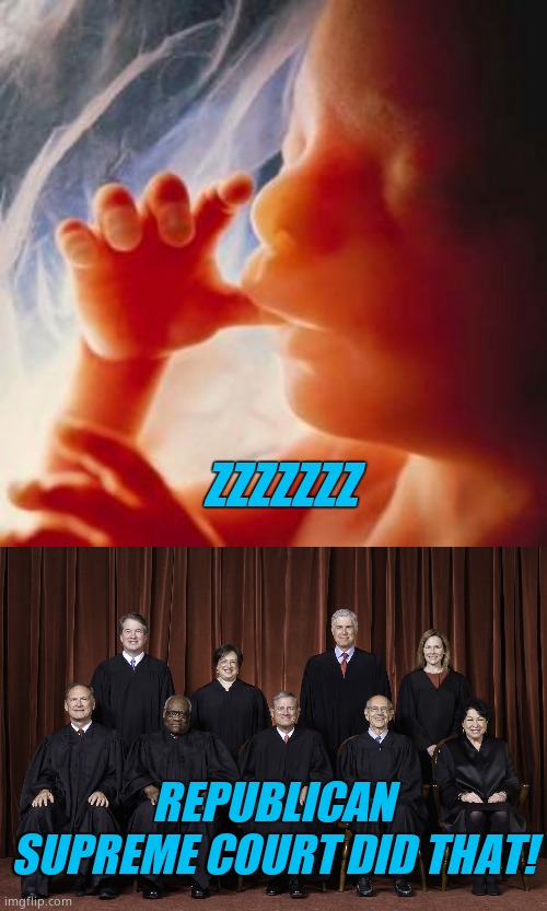 ZZZZZZZ REPUBLICAN SUPREME COURT DID THAT! | image tagged in fetus,scotus supreme court 2022 | made w/ Imgflip meme maker