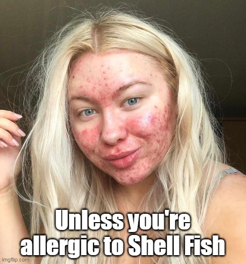 Unless you're allergic to Shell Fish | made w/ Imgflip meme maker