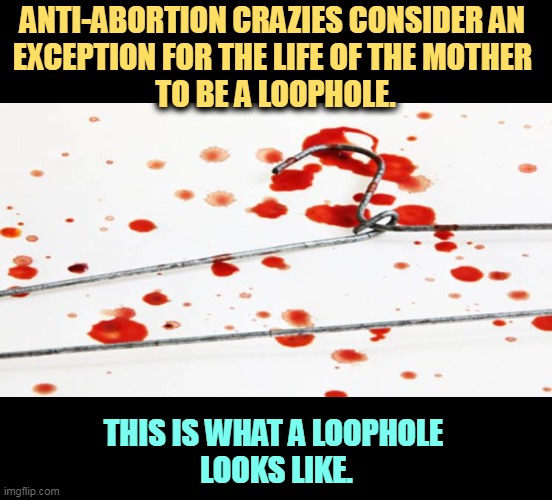 Your wife is a loophole. Your sister is a loophole. Your daughter is a loophole. Your granddaughter is a loophole. | ANTI-ABORTION CRAZIES CONSIDER AN 
EXCEPTION FOR THE LIFE OF THE MOTHER 
TO BE A LOOPHOLE. THIS IS WHAT A LOOPHOLE 
LOOKS LIKE. | image tagged in anti,abortion,crazy,hate,women,dead | made w/ Imgflip meme maker