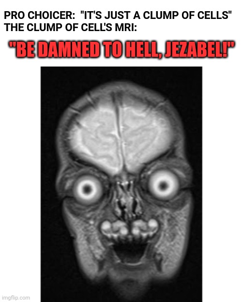 The face u make when u're called "a clump of cells" | PRO CHOICER:  "IT'S JUST A CLUMP OF CELLS"



THE CLUMP OF CELL'S MRI:; "BE DAMNED TO HELL, JEZABEL!" | image tagged in prochoice,roevwade,prolife,sciencememes | made w/ Imgflip meme maker