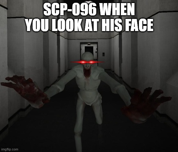 Whoever looks at SCP-096's face is in danger | SCP-096 WHEN YOU LOOK AT HIS FACE | image tagged in scp 096 | made w/ Imgflip meme maker