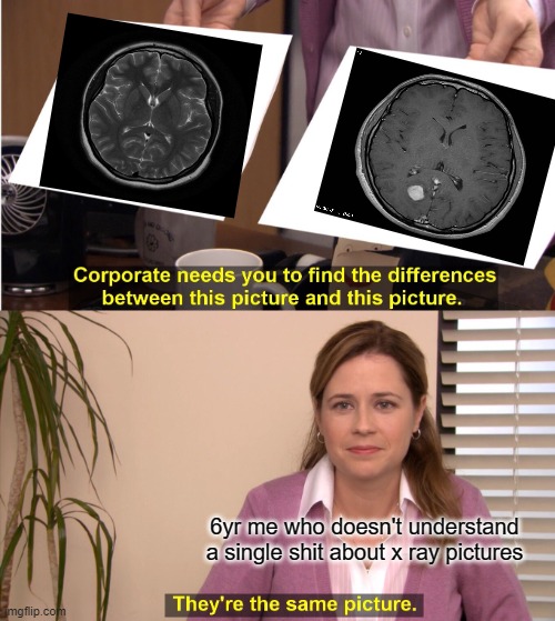 relatable? | 6yr me who doesn't understand a single shit about x ray pictures | image tagged in memes,they're the same picture | made w/ Imgflip meme maker