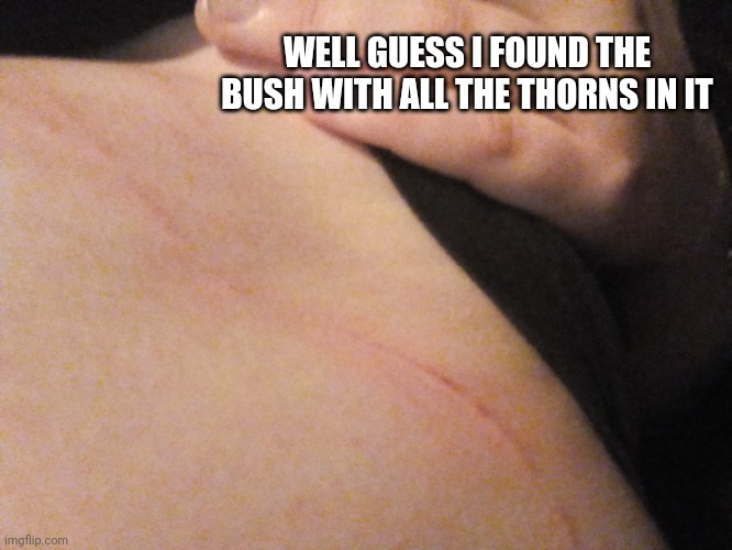 That's my stomach btw if you couldn't tell | WELL GUESS I FOUND THE BUSH WITH ALL THE THORNS IN IT | made w/ Imgflip meme maker