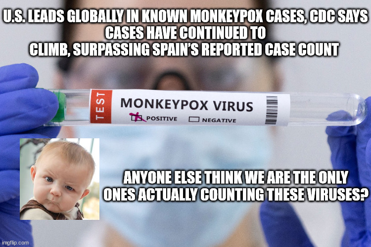 I am Skeptical | U.S. LEADS GLOBALLY IN KNOWN MONKEYPOX CASES, CDC SAYS
CASES HAVE CONTINUED TO CLIMB, SURPASSING SPAIN’S REPORTED CASE COUNT; ANYONE ELSE THINK WE ARE THE ONLY ONES ACTUALLY COUNTING THESE VIRUSES? | image tagged in monkeypox,cdc,politics,the truth | made w/ Imgflip meme maker