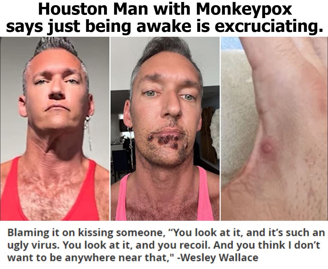 Houston, we've got a problem. | image tagged in monkeypox,the book of faggets,faggot,gay sex,butt sex,never go full retard | made w/ Imgflip meme maker