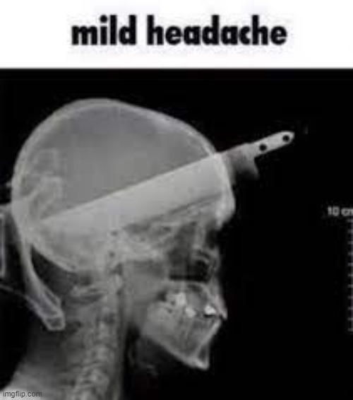 mild headache | image tagged in mild headache | made w/ Imgflip meme maker