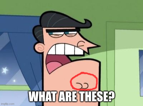 Dinkleberg | WHAT ARE THESE? | image tagged in dinkleberg | made w/ Imgflip meme maker
