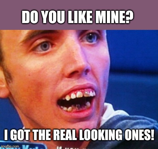 British Teeth  | DO YOU LIKE MINE? I GOT THE REAL LOOKING ONES! | image tagged in british teeth | made w/ Imgflip meme maker