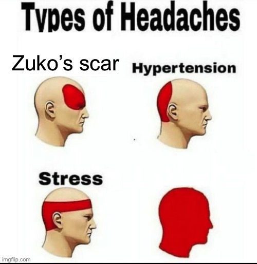 It looks like Zuko’s scar.. | Zuko’s scar | image tagged in types of headaches meme,avatar the last airbender,avatar,zuko | made w/ Imgflip meme maker