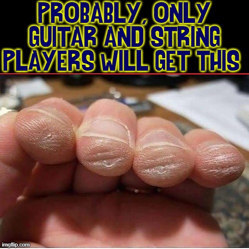 Dedication has a Price! |  PROBABLY, ONLY GUITAR AND STRING PLAYERS WILL GET THIS | image tagged in vince vance,guitars,memes,callous,fingers,dedication | made w/ Imgflip meme maker