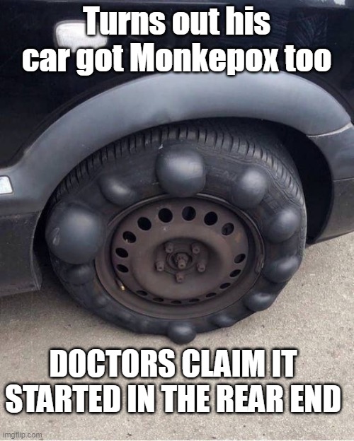 Evidently, it is an epidemic | Turns out his car got Monkepox too; DOCTORS CLAIM IT STARTED IN THE REAR END | made w/ Imgflip meme maker