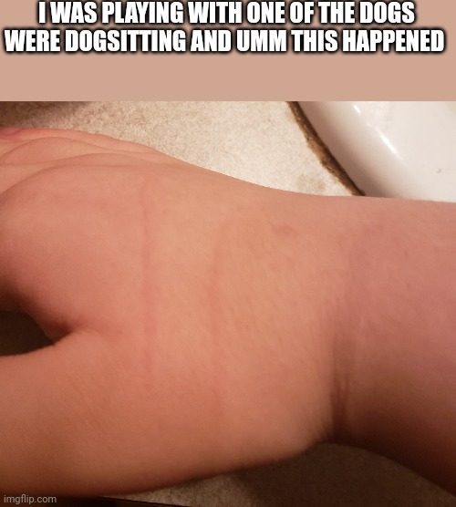 Ouch :< | I WAS PLAYING WITH ONE OF THE DOGS WERE DOGSITTING AND UMM THIS HAPPENED | image tagged in oof | made w/ Imgflip meme maker