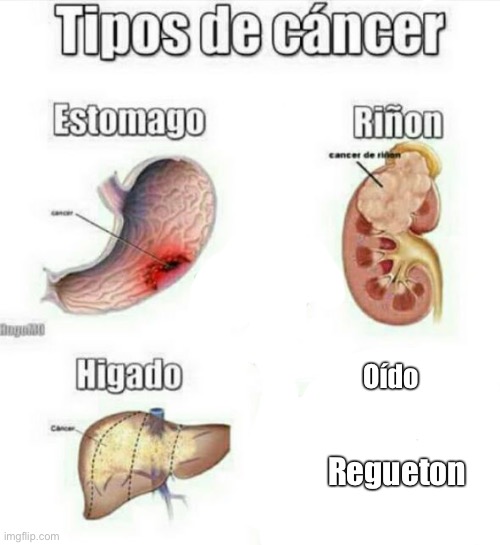 Oído; Regueton | image tagged in cancer | made w/ Imgflip meme maker