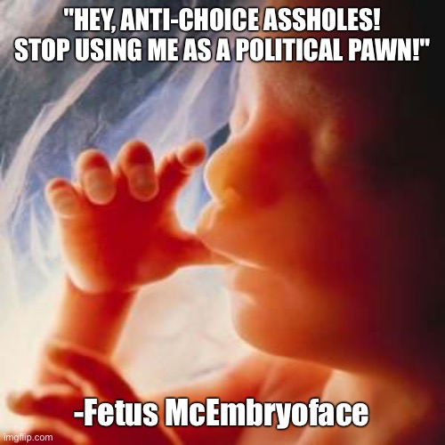 If they can make up stuff no fetus ever said, so can I | "HEY, ANTI-CHOICE ASSHOLES! STOP USING ME AS A POLITICAL PAWN!"; -Fetus McEmbryoface | image tagged in fetus,jerkface | made w/ Imgflip meme maker
