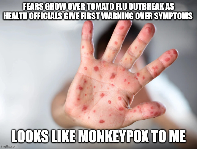 What? | FEARS GROW OVER TOMATO FLU OUTBREAK AS HEALTH OFFICIALS GIVE FIRST WARNING OVER SYMPTOMS; LOOKS LIKE MONKEYPOX TO ME | image tagged in monkeypox | made w/ Imgflip meme maker