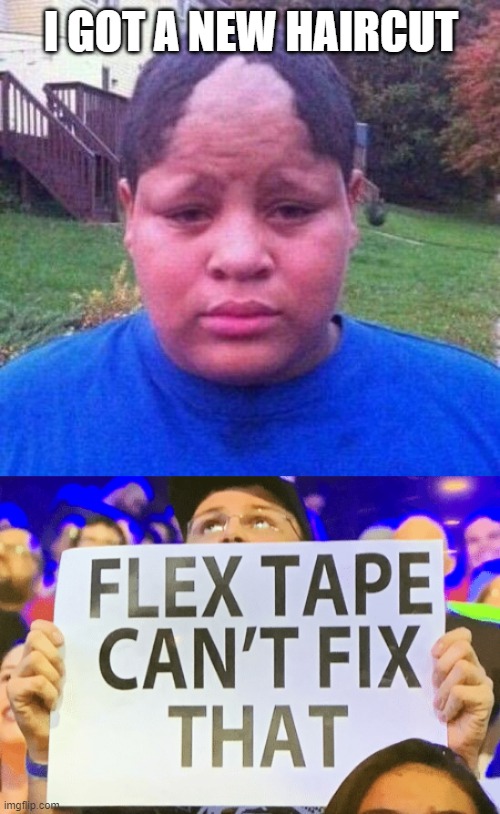 Burn | I GOT A NEW HAIRCUT | image tagged in bad hairline,flex tape cant fix that | made w/ Imgflip meme maker