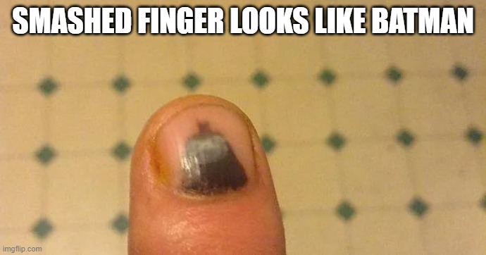 SMASHED FINGER LOOKS LIKE BATMAN | image tagged in memes | made w/ Imgflip meme maker